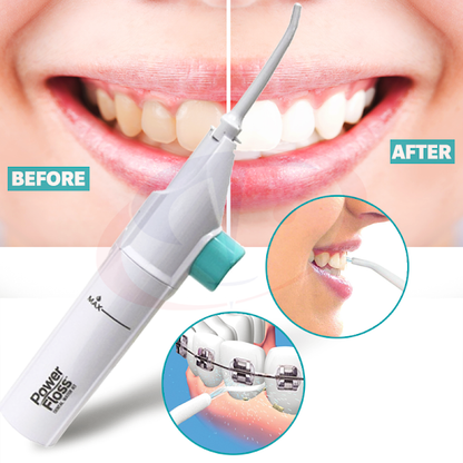 Irigator bucal pentru curatare dentara Power Floss — Confort Personal Zi de Zi